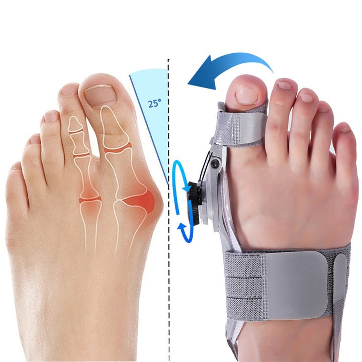 TreatMedy Bunion Fix Corrector