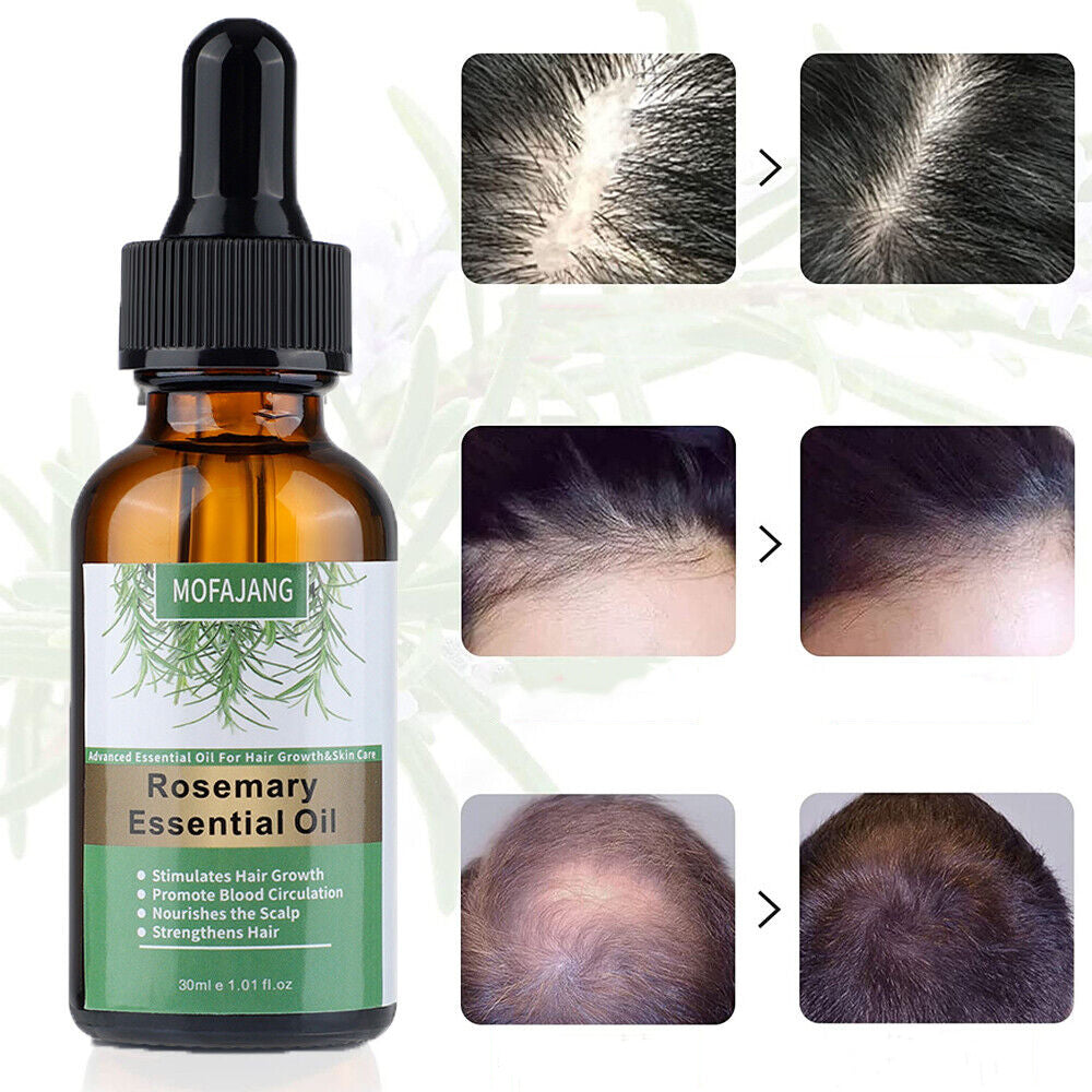 Organic Rosemary Hair Growth Oil